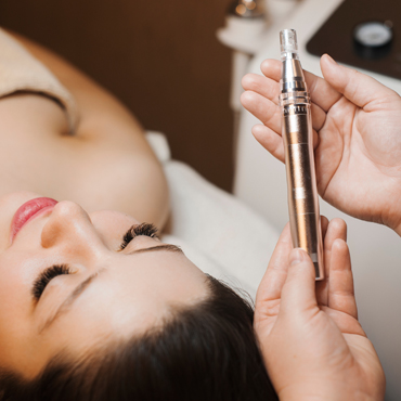 Microneedling